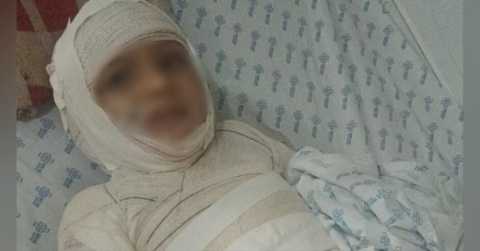 vaquinha-para-crianca-queimada-fazendo-“arte”-ultrapassa-r$-5-mil